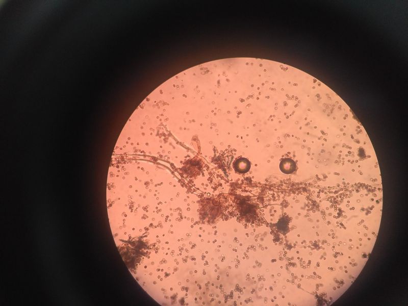 Mikrobiologie mj. zkoumá mikroorganismy v petriho misce. Autor: Muhammad Farhan, zdroj: Pixabay